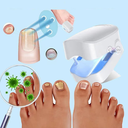 Laser Nail Pro® - Dispositivo láser para tratamiento de hongos en las uñas