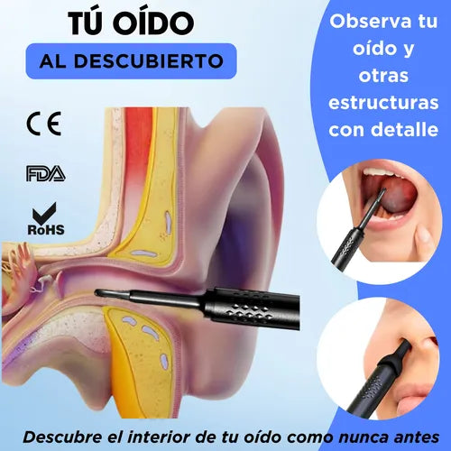 Limpiador de Oídos 360👂 - Cámara Integrada - Visualiza y elimina la cera en segundos.